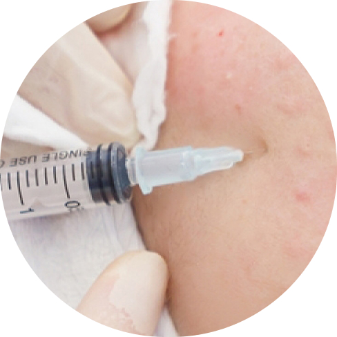 treatment img