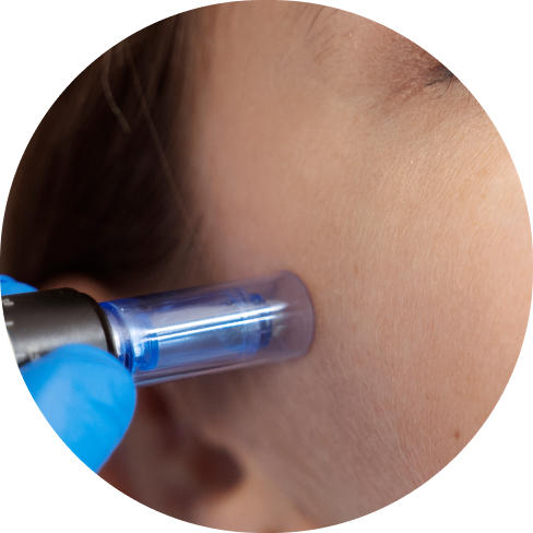 treatment img