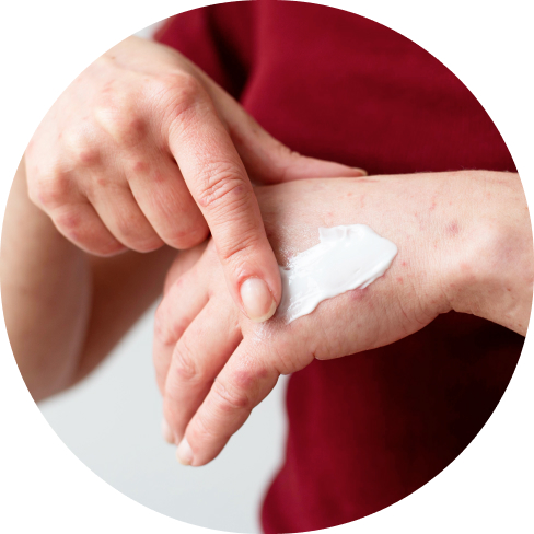 treatment img