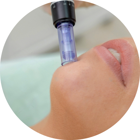 treatment img