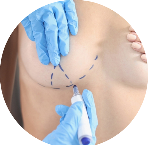 treatment img