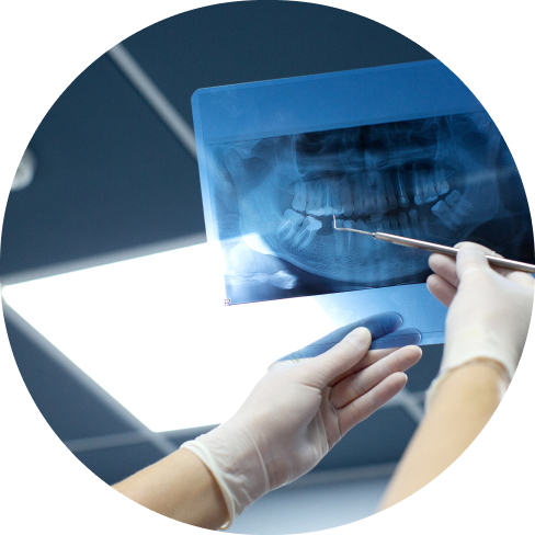 treatment img