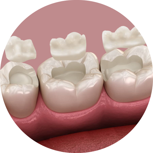 treatment img