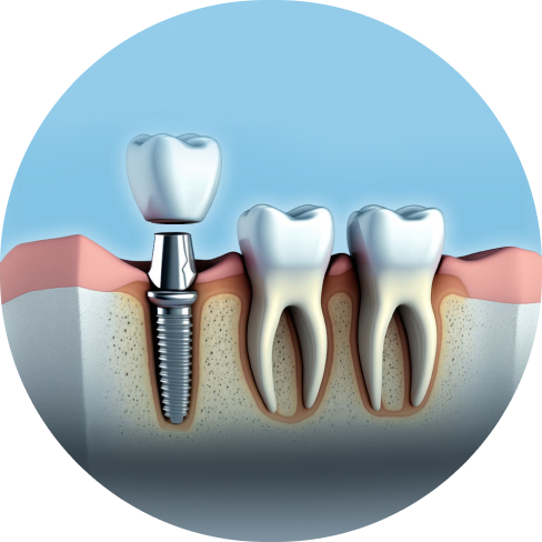 treatment img