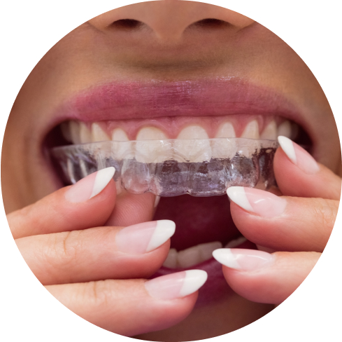 treatment img