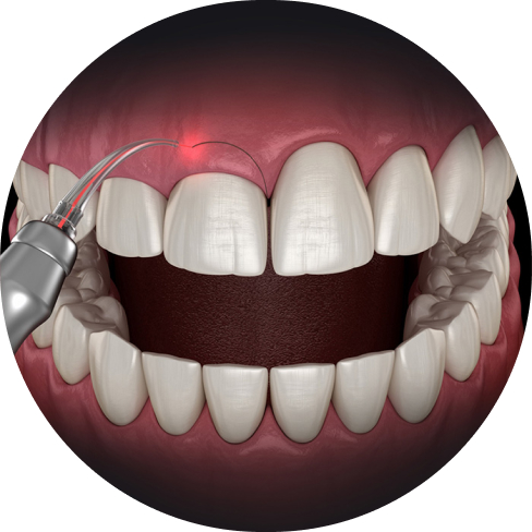 treatment img
