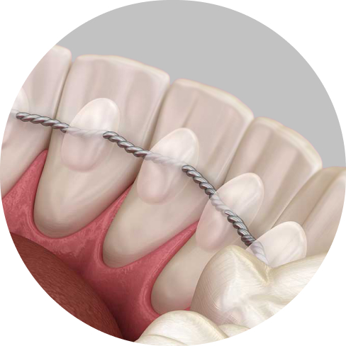 treatment img
