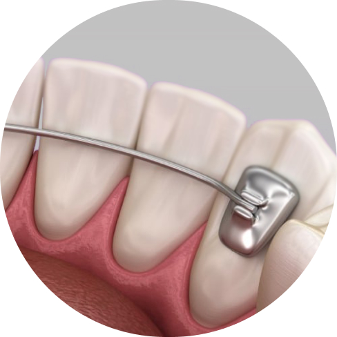 treatment img