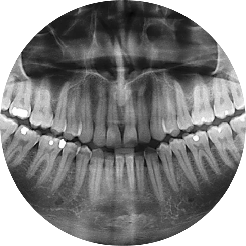 treatment img
