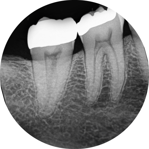 treatment img
