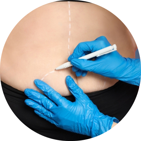 treatment img