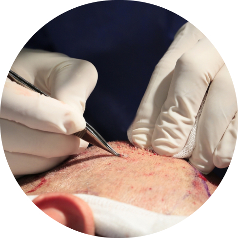 treatment img