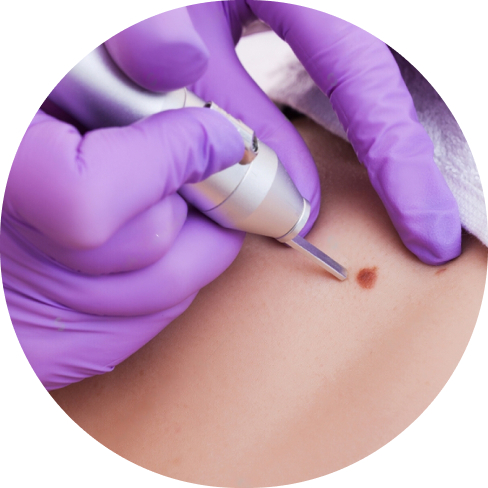treatment img