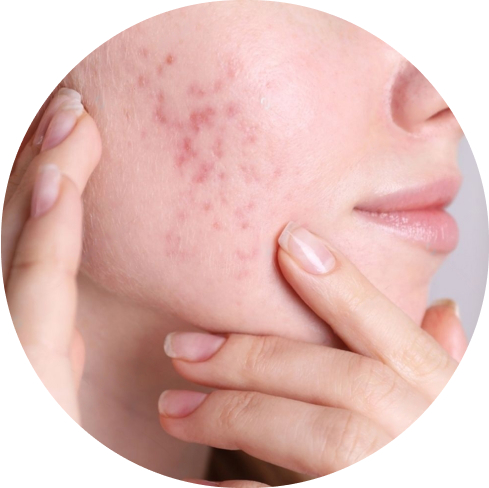 treatment img