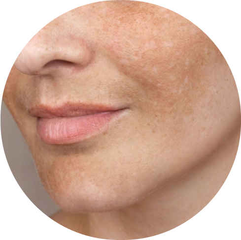 treatment img