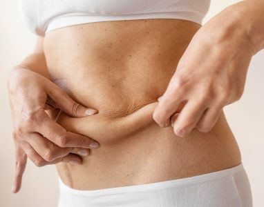 Liposuction Recovery Timeline & What To Expect