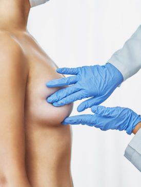 breast reconstruction1